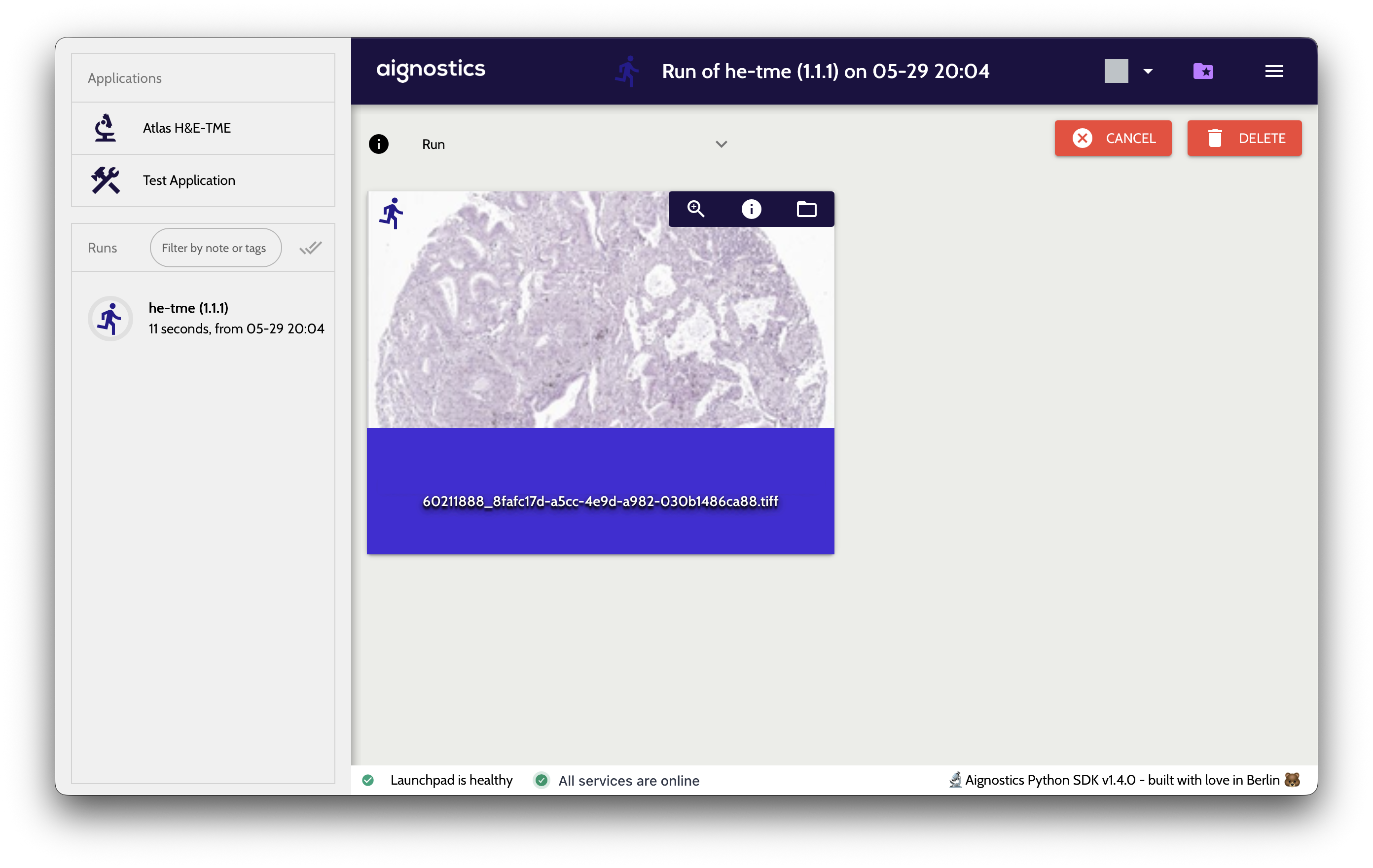 The left sidebar showing a run in progress and a completed run