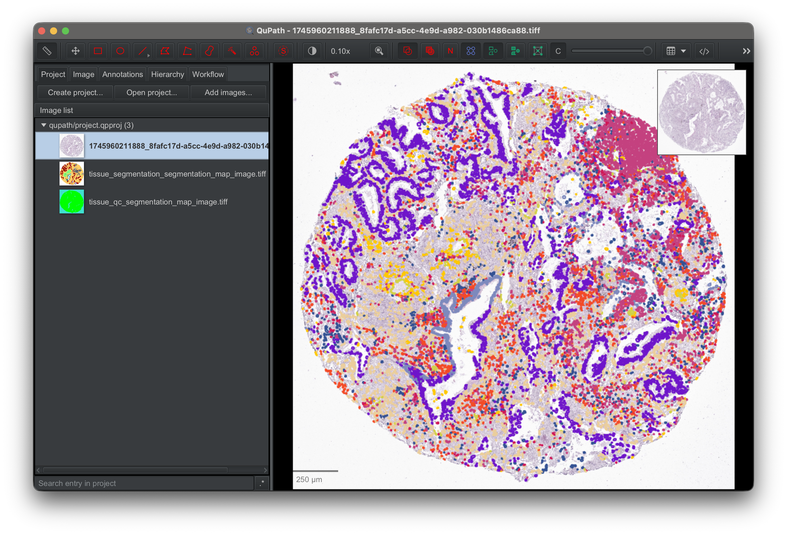 The slide open in QuPath with tissue and cell annotations